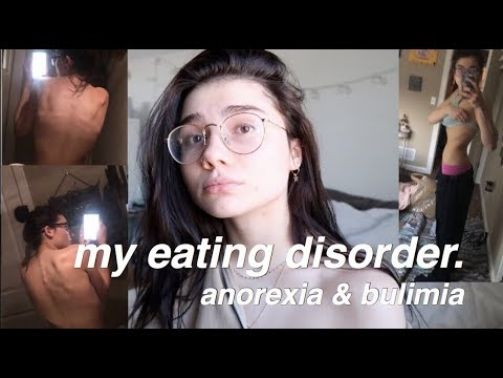 My Eating Disorder Story (Anorexia & Bulimia)