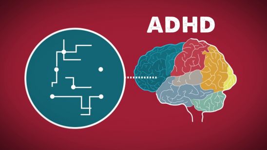 The Brain on ADHD