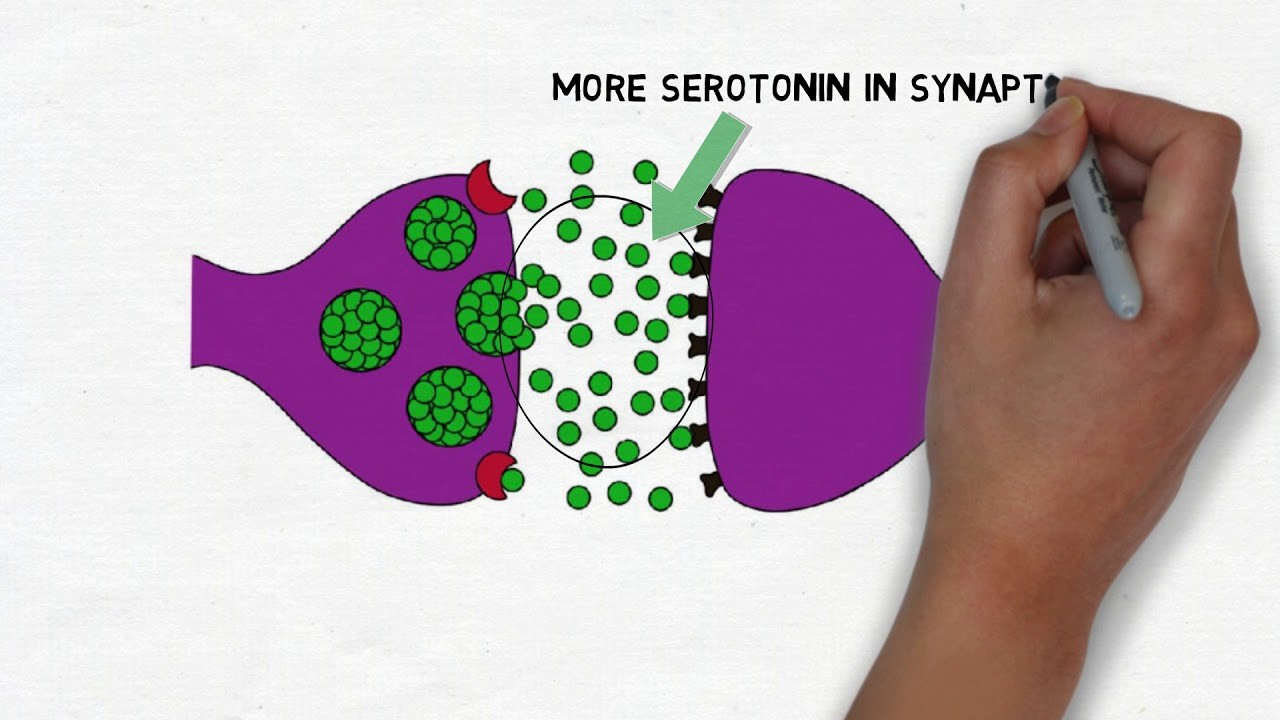 Selective Serotonin Reuptake Inhibitors (SSRIs)
