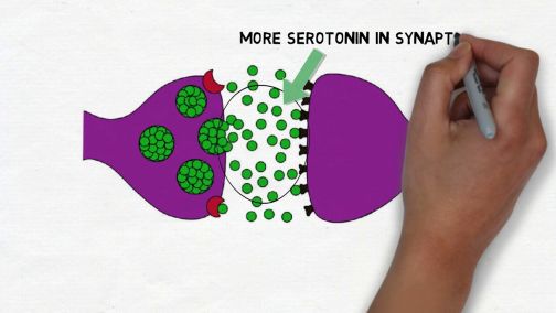 Selective Serotonin Reuptake Inhibitors (SSRIs)